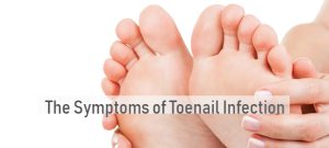 Symptoms of Toenail Infection
