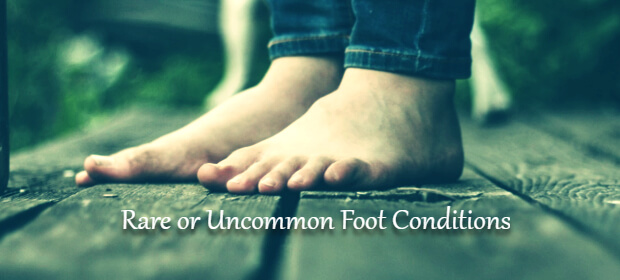 Rare or Uncommon Foot Conditions Never be Ignored