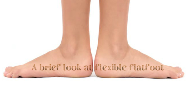 Flexible Flatfoot